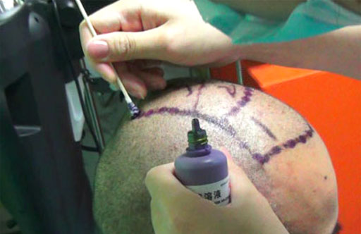 �ƶ�����ֲ������