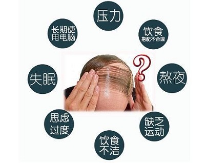 曙光毛发移植毛发移植案例效果图