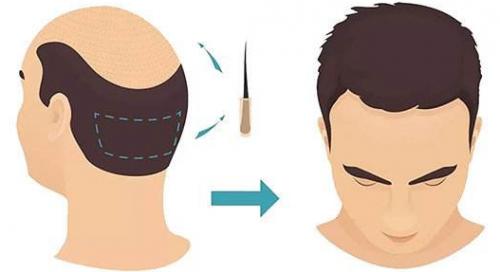 ֲ����ǧ����λ��ֲ������