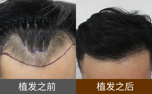 ��ĦͷƤ����������