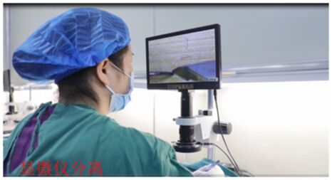 南京头发移植后还会脱发吗