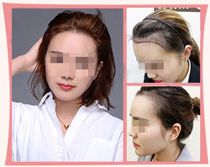 Ů��ֲ��Ч��ͼ