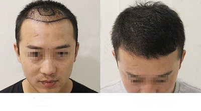 ��ô����ֲ��ë�ҵĴ������?