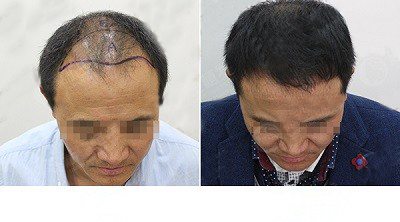 ��ֲ����Ч����ô����?