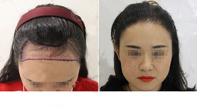 Ϊʲô���ѷ�?��ô�����?