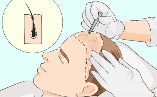 ��ͷ����ֲ���ѡ��ҽԺ��ҽ��