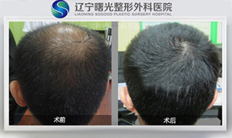 ֲ����Ŀ�����?