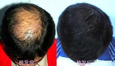 ͷ����ֲ�ɿ�ô?��Ҫ����Ǯ?