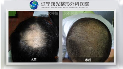 �ѷ�����ͷ����ֲ��ô?