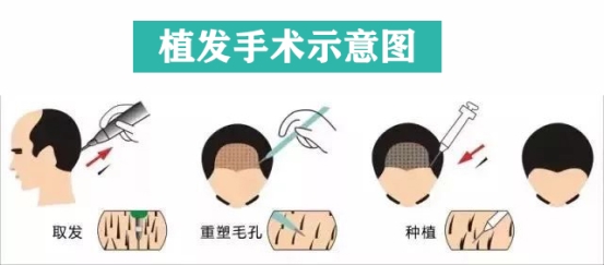 ֲ��800��λ�ж��