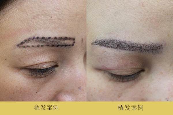 üë��ֲЧ��ͼ