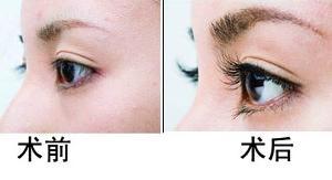 üë��ֲ����֢����Щ