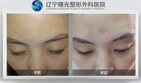 üë��ֲ����Ҷü������