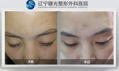 üë��ֲʱ�����ѡ��ü����?