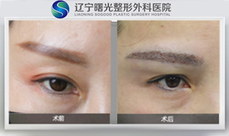 üë��ֲ�Ա�ͼ