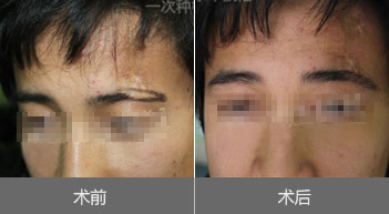 üë��ֲЧ��ͼ