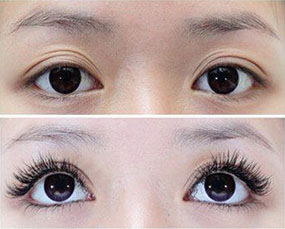 睫毛种植对比图
