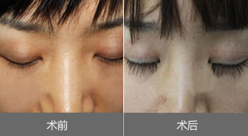 ��ë��ֲЧ��ͼ