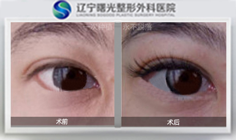 睫毛种植4.jpg