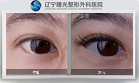 睫毛种植效果图
