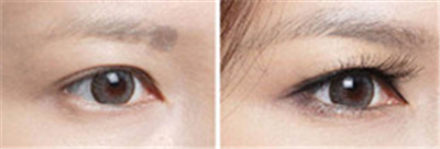 沈阳睫毛种植效果怎么样呢
