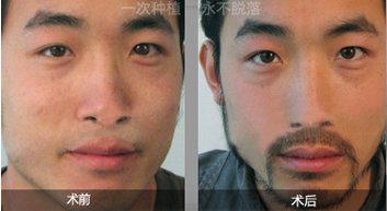 ������ֲ