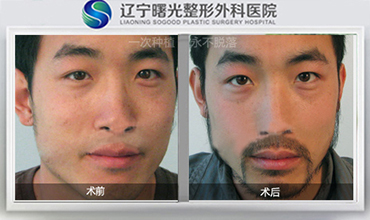 ������ֲ����Ӧ֢