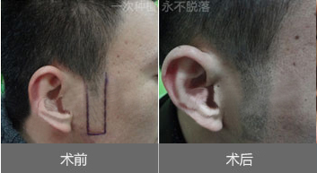 �޽���ֲ���������ж��?