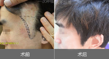 �޽���ֲҪ����Ǯ��?