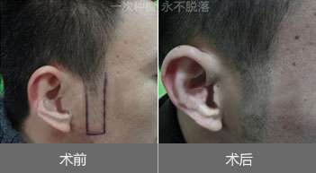 �޽���ֲ��Σ����?