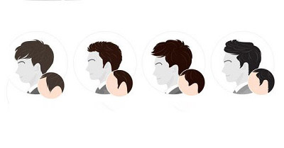 �޽�ֲ����Ҫ����Ǯ