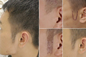 �޽���ֲ�������