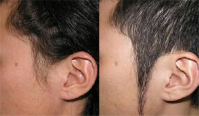 �����޽���ֲ�ļ۸����Ƕ���