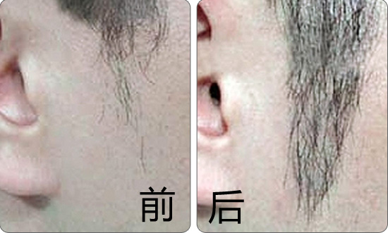 ��ֲ�޽���Ҫע����Щ