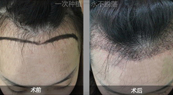 ������˼���ֲ����