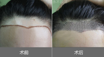 ���˼���ֲ����Щ����