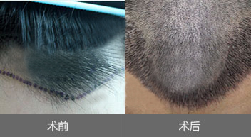 ���˼���ֲЧ��ͼ