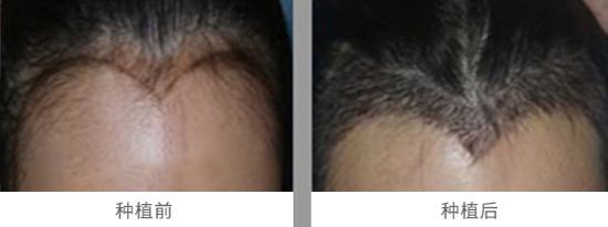 ���ҽ�����˼���ֲ