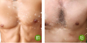 ��������ë���