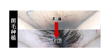 ��ë��ֲ����Ǯ��