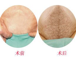 ��ֲ�Ȼ���