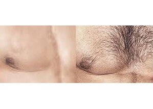 没有胸毛怎么办?