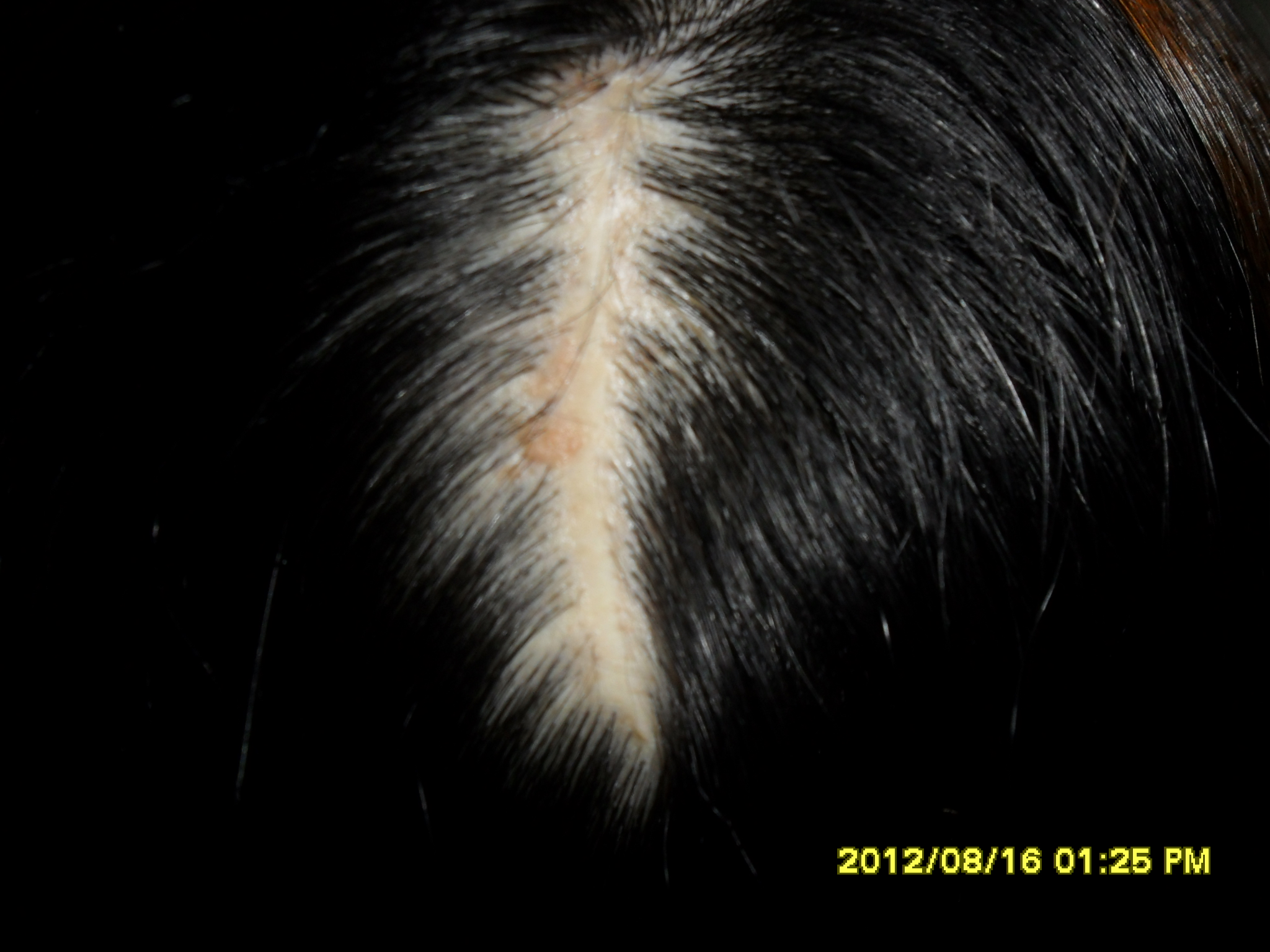 ʲô�ǰ̺���ֲ