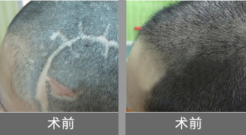 �̺���ֲЧ��ͼ