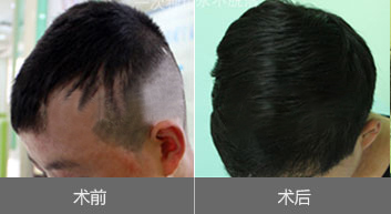 �̺���ֲЧ��ͼ