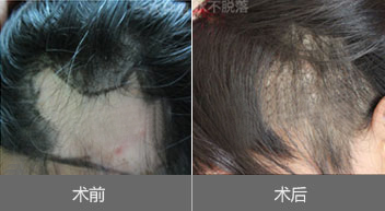 �̺���ֲЧ��ͼ