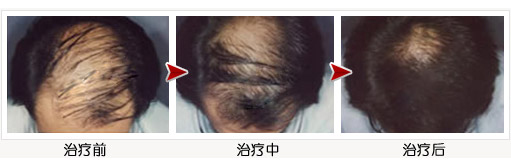 ͷ��ϡ����ô��ͷ������