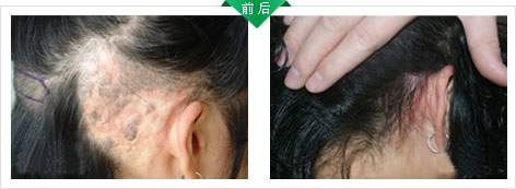 �̺��ܽ���ͷ����ֲô?