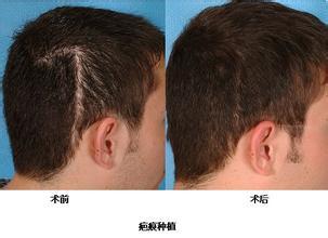 �̺�ֲ�������ô����