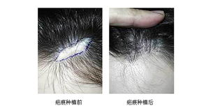 �̺���ֲ��ô��